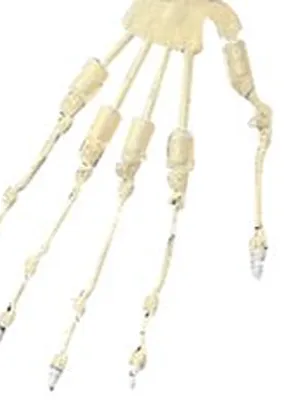 Finger Joints